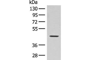 Western blot analysis of Hela cell lysate using FAM50A Polyclonal Antibody at dilution of 1:300 (FAM50A antibody)