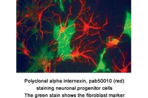 Image no. 1 for anti-Internexin Neuronal Intermediate Filament Protein, alpha (INA) antibody (ABIN363319) (INA antibody)