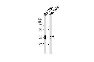 Western blot analysis of lysates from SH-SY5Y, Neuro-2a cell line (from left to right), using (Mouse) Msi1 Antibody (Center) (ABIN6243867 and ABIN6577735). (MSI1 antibody  (AA 81-113))