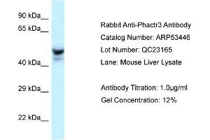 Western Blotting (WB) image for anti-Phosphatase and Actin Regulator 3 (PHACTR3) (Middle Region) antibody (ABIN2785397) (PHACTR3 antibody  (Middle Region))