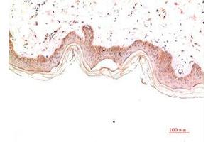 Immunohistochemical analysis of paraffin-embedded Human Skin Tissue using Collagen IV Mouse mAb diluted at 1:2000 (COL4A1 antibody)