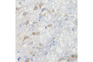 Immunohistochemistry of paraffin-embedded rat brain using CHIC2 antibody (ABIN5974773) at dilution of 1/100 (40x lens). (CHIC2 antibody)