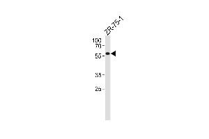 P2R2A Antibody (N-term) (ABIN1881683 and ABIN2843430) western blot analysis in ZR-75-1 cell line lysates (35 μg/lane). (PPP2R2A antibody  (N-Term))