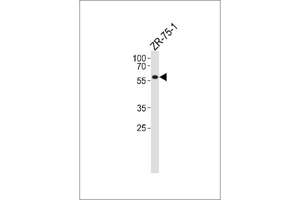 PPP2R2A antibody  (N-Term)