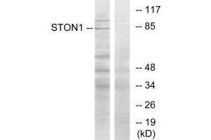Western blot analysis of extracts from K562 cells, using STON1 antibody.