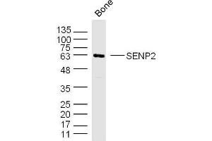 Mouse bone lysates probed with SENP2 Polyclonal Antibody, unconjugated  at 1:300 overnight at 4°C followed by a conjugated secondary antibody for 60 minutes at 37°C. (SENP2 antibody  (AA 1-100))