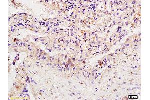 Formalin-fixed and paraffin embedded rat colitis labeled with Anti-IRF-1/MAR1 Polyclonal Antibody, Unconjugated (ABIN686062) at 1:200 followed by conjugation to the secondary antibody and DAB staining. (IRF1 antibody)