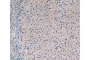 IHC-P analysis of Mouse Ovary Tissue, with DAB staining. (SYN1 antibody  (AA 113-420))