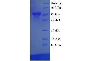 SDS-PAGE (SDS) image for TEA Domain Family Member 1 (SV40 Transcriptional Enhancer Factor) (TEAD1) (AA 1-426), (full length) protein (His tag) (ABIN4975779)