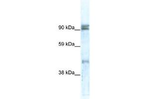 WB Suggested Anti-ZNF227 Antibody Titration:  0. (ZNF227 antibody  (N-Term))