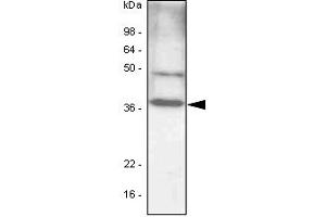 The cell lysates (40ug) were resolved by SDS-PAGE, transferred to PVDF membrane and probed with anti-human C/EBP-beta antibody (1:1000). (CEBPB antibody)