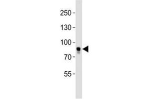Western blot analysis of lysate from MCF-7 cell line using BRAF antibody. (BRAF antibody  (AA 580-609))