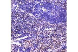 IHC testing of FFPE rat spleen tissue with NKp46 antibody at 1ug/ml. (NCR1 antibody)