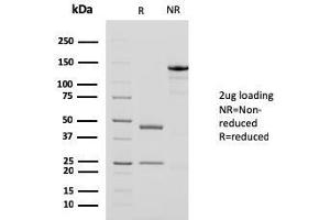 SDS-PAGE Analysis Purified Smooth Muscle Actin MAb (1A4 + ACTA2/791). (Smooth Muscle Actin antibody  (N-Term))