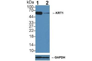 Western blot analysis of (1) Wild-type A431 cell lysate, and (2) KRT1 knockout A431 cell lysate, using Rabbit Anti-Human KRT1 Antibody (3 µg/ml) and HRP-conjugated Goat Anti-Mouse antibody (abx400001, 0.