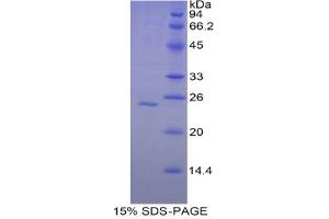 SDS-PAGE analysis of Human Glutathione synthetase Protein.