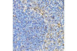 Immunohistochemistry of paraffin-embedded mouse spleen using ST antibody (ABIN6128538, ABIN6148573, ABIN6148574 and ABIN6222755) at dilution of 1:100 (40x lens). (STAT4 antibody  (AA 569-748))