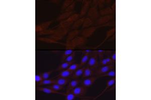 Immunofluorescence (IF) image for anti-Sodium Channel, Nonvoltage-Gated 1 alpha (SCNN1A) (AA 105-225) antibody (ABIN6147447)
