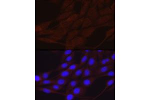 Immunofluorescence analysis of NIH/3T3 cells using SCNN1A Rabbit pAb (ABIN6129465, ABIN6147447, ABIN6147448 and ABIN6221186) at dilution of 1:200 (40x lens). (SCNN1A antibody  (AA 105-225))