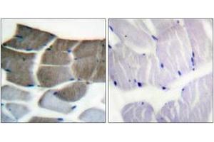 Immunohistochemistry analysis of paraffin-embedded human skeletal muscle tissue, using ACC1 (Ab-80) Antibody. (Acetyl-CoA Carboxylase alpha antibody  (AA 46-95))