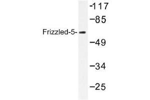 Image no. 1 for anti-Frizzled Family Receptor 5 (FZD5) antibody (ABIN317751) (FZD5 antibody)