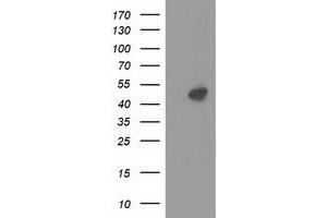 HEK293T cells were transfected with the pCMV6-ENTRY control (Left lane) or pCMV6-ENTRY PRKAR2A (Right lane) cDNA for 48 hrs and lysed. (PRKAR2A antibody)