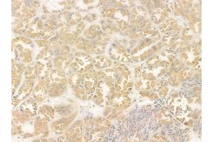 anti-Olfactory Receptor, Family 51, Subfamily I, Member 1 (OR51I1) (N-Term) antibody