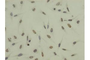 Immunocytochemistry analysis of Hela cells using ABIN7139668 at dilution of 1:100 (HIST1H3A antibody  (3meLys27))