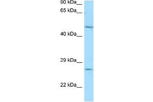 WB Suggested Anti-Entpd1 Antibody Titration: 1. (CD39 antibody  (N-Term))
