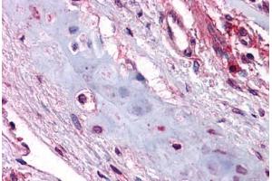Human Lung, Chondrocytes: Formalin-Fixed, Paraffin-Embedded (FFPE) (UCMA antibody  (C-Term))