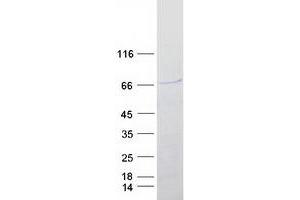 SOX4 Protein (Myc-DYKDDDDK Tag)