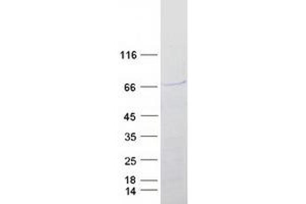 SOX4 Protein (Myc-DYKDDDDK Tag)