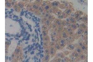 Detection of TRAF2 in Mouse Liver Tissue using Polyclonal Antibody to TNF Receptor Associated Factor 2 (TRAF2) (TRAF2 antibody  (AA 238-491))