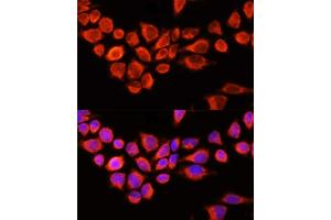 Immunofluorescence analysis of 293T cells using AADAC antibody (ABIN6129182, ABIN6136311, ABIN6136313 and ABIN6218113) at dilution of 1:100 (40x lens). (AADAC antibody  (AA 170-399))