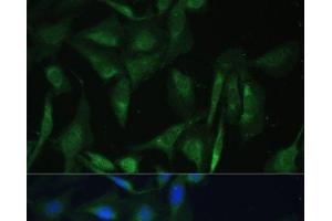 Immunofluorescence analysis of U-2 OS cells using CAMLG Polyclonal Antibody at dilution of 1:100 (40x lens). (CAMLG antibody)