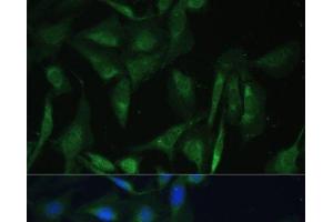 Immunofluorescence analysis of U-2 OS cells using CAMLG Polyclonal Antibody at dilution of 1:100 (40x lens). (CAMLG antibody)