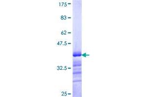 BACH1 Protein (AA 396-492) (GST tag)