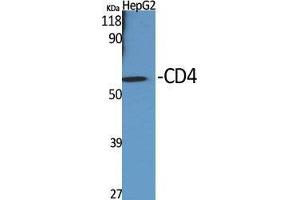 Western Blot (WB) analysis of specific cells using CD4 Polyclonal Antibody. (CD4 antibody  (Ser213))
