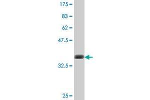 Western Blot detection against Immunogen (37. (PKC epsilon antibody  (AA 301-400))