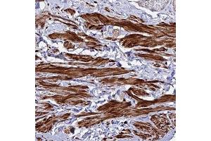 Immunohistochemical staining of human smooth muscle with ARL6IP1 polyclonal antibody ( Cat # PAB28311 ) shows strong cytoplasmic positivity in smooth muscle cells.