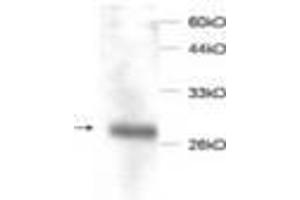 Image no. 1 for anti-Macrophage Migration Inhibitory Factor (Glycosylation-Inhibiting Factor) (MIF) antibody (ABIN791498) (MIF antibody)