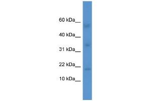 Western Blotting (WB) image for anti-Interleukin 1 Family, Member 10 (Theta) (IL1F10) (Middle Region) antibody (ABIN2788385) (IL1F10 antibody  (Middle Region))