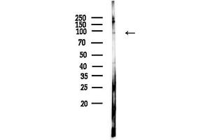 anti-Interferon, gamma-Inducible Protein 16 (IFI16) (C-Term) antibody