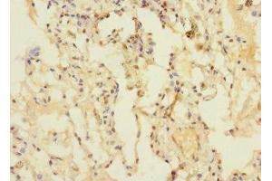 Immunohistochemistry of paraffin-embedded human lung tissue using ABIN7150754 at dilution of 1:100 (DUSP16 antibody  (AA 416-665))