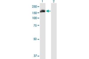 Western Blot analysis of FAM62A expression in transfected 293T cell line by FAM62A MaxPab polyclonal antibody. (ESYT1 antibody  (AA 1-1104))