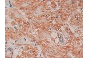 Detection of FLNC in Human Prostate Tissue using Polyclonal Antibody to Filamin C Gamma (FLNC) (FLNC antibody  (AA 17-259))