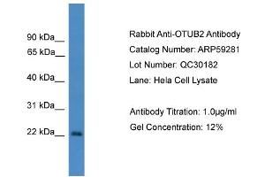 WB Suggested Anti-OTUB2  Antibody Titration: 0. (OTUB2 antibody  (N-Term))