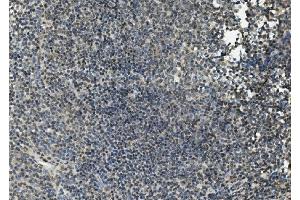 IHC analysis of FLI1 using anti-FLI1 antibody (ABIN7599409). (FLI1 antibody  (AA 1-452))