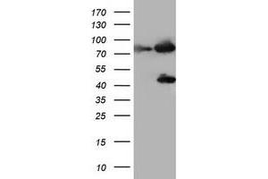 Image no. 1 for anti-Coagulation Factor XIII, A1 Polypeptide (F13A1) antibody (ABIN1498155) (F13A1 antibody)