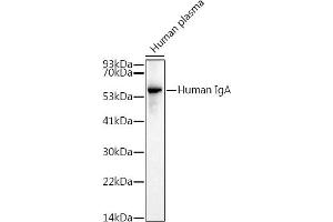 Western blot analysis of extracts of Human plasma, using Human IgA antibody (ABIN7267840) at 1:1000 dilution. (IGHA1 & IGHA2 antibody)